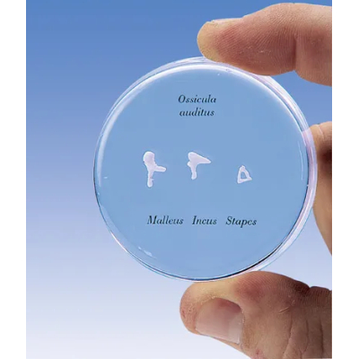 1000253 Gehoorbeentjes