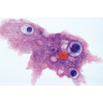 1003960 Protozoa Preparaten